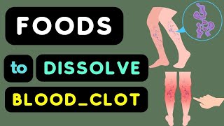 Blood Clots In Leg  7 Amazing Foods That Dissolve Blood Clots In Legs Naturally [upl. by Aissatan]