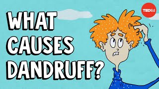 What causes dandruff and how do you get rid of it  Thomas L Dawson [upl. by Tabib552]