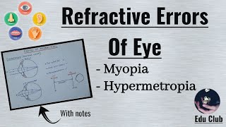 Refractory Errors Of Eye  Myopia  Hypermetropia  Special Senses Physiology [upl. by Eniamahs]