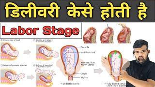 डिलीवरी केसे होती है  Labor Stage  Pregnancy  Medicine  Treatment  Hospital Knowledge  Doctor [upl. by Essie530]