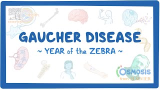 Gaucher disease  NORD Year of the Zebra [upl. by Ajidahk185]