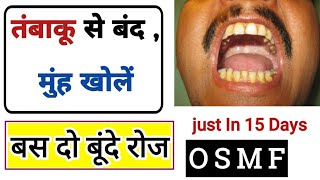 15 दिन में पूरा मुह खोले  oral sabmucous fibrosis Treatment  OSMF  SMF gel use  Dr tarun [upl. by Chancey]