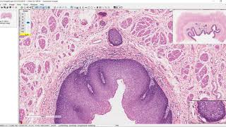 Unit 4 histo Esophagus [upl. by Tasiana]