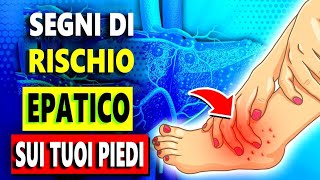 9 Segreti Con Cui I Tuoi Piedi Possono Svelare La Salute Del Tuo Fegato [upl. by Eico]