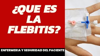 ¿Que es la flebitis enfermería [upl. by Judson]