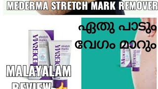 Mederma stretch mark removel creamstretch mark therapy [upl. by Frankhouse889]