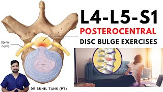 L4L5S1 posterocentral disc bulge exercises  L4L5 and L5S1 central disc bulge treatment in hindi [upl. by Anirok]