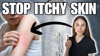 How To Stop Itchy Skin After Shower  Dermatologist Tips [upl. by Sudnac332]