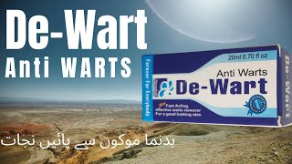 DeWart Anti Warts 20ml REVIEW  BENEFITS  PRICE  UrduHindi  amforiapk [upl. by Athalla]