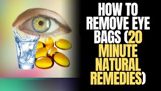 Say Goodbye to Eye Bags 20Minute Natural Remedies You Can Try at Home [upl. by Ttennaj930]