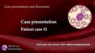 Patient case presentation case 2 [upl. by Torie]