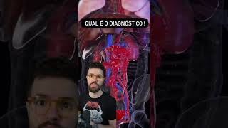 ✨ El tratamiento quirúrgico de la rotura de un aneurisma de la aorta abdominal [upl. by Atauqal771]