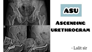 Ascending urethrogram  ASU  scparamedicalinstitute8221 [upl. by Briggs]