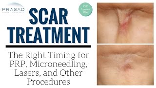 Modes and Timing of Treatment for Wounds and Older Scars Including Acne Scarring [upl. by Wiersma]