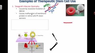 What is stem cell therapy [upl. by Aidam]