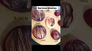 Cervical Dilation cervix cervical pregnant midwife [upl. by Desdamona913]