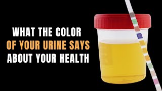 What The Color Of Your Urine Says About Your Health [upl. by Alletsyrc]