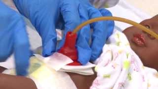 Caring for My Child with a Gastrostomy Tube  St Louis Childrens Hospital [upl. by Reimer]