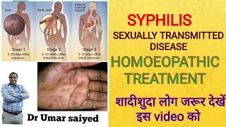 SYPHILIS HOMOEOPATHIC TREATMENT [upl. by Jo Ann]