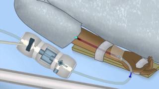 Pulmonary Artery PA Catheter Waveforms EXPLAINED [upl. by Gnot]