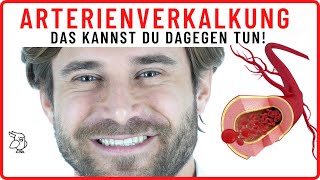 ✅ARTERIENVERKALKUNG ENTFERNEN✅ 8 Tipps um deine Arterien zu reinigen – Arteriosklerose vorbeugen [upl. by Gilli]