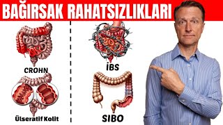 Bağırsak Rahatsızlıkları Crohn İBS Ülseratif Kolit SIBO İçin En Kolay Test  DrBerg Türkçe [upl. by Cosenza]