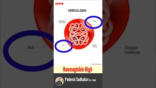 High Hemoglobin  🩸 hemoglobin hb அதிகபட்ச ஹீமோகுளோபின் என்ன  🩸❤️‼️ [upl. by Mahda]