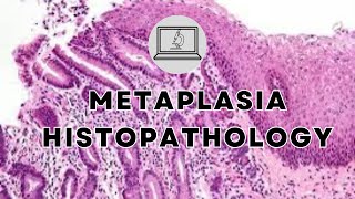 METAPLASIA  HISTOPATHOLOGY AND MORPHOLOGY [upl. by Kiehl]