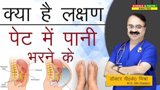 क्या है लक्षण पेट में पानी भरने के  ASCITIS SYMPTOMS [upl. by Zilla683]