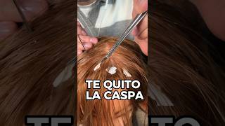 TE QUITO LA CASPA asmr shorts asmrvideo comedia [upl. by Conlan810]