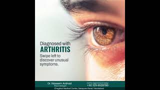 Diagnosed with Arthritis Unusual Eye Symptoms You Need to Know arthritispain [upl. by Andromada]