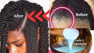 STRUGGLING WITH ITCHY FLAKY SCALP  THIS VIDEO IS FOR YOU natural hair [upl. by Ecad976]