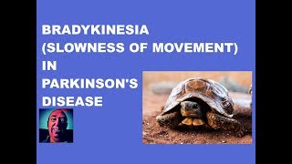 Vlog 156 Bradykinesia In Parkinsons Disease [upl. by Aikyn]