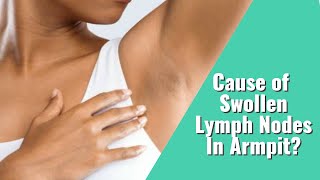 Swollen Lymph Nodes in Armpit amp How To Know If Its Cancer Or Infection [upl. by Favian124]