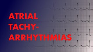 Atrial Arrhythmias Afib vs AFlutter vs Focal vs Multifocal Atrial Tachycardia  MEDZCOOL [upl. by Ytnom]