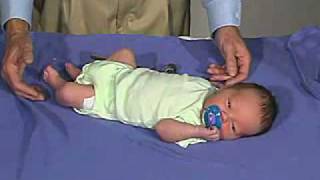 physical exam Newborn Normal Tone  Resting Posture [upl. by Buffy]