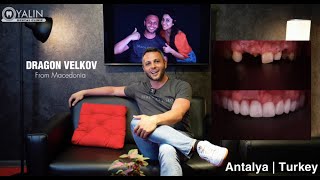 Dental Care in Turkey Antalya  YALIN Dental Clinic teethturkey turkeyteeth dentiststurkey [upl. by Aeriell]