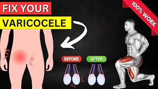 👉5 Effective Varicocele Exercises to Relieve Pain [upl. by Euphemia]