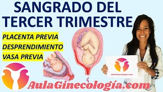 ENFERMEDAD INFLAMATORIA PÉLVICA EPI PACIENTES síntomas y tratamiento Ginecología y Obstetricia [upl. by Belen]