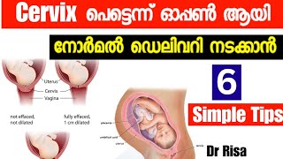 Cervix Dilating Exercise MalayalamNatural Way To Induce LaborDelivery Tips [upl. by Halihs]