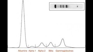 Electrophorèse des protéines sériques [upl. by Annhoj]