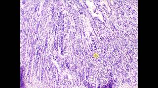 Simple columnar epithelium with goblet cells Duodenum [upl. by Ani]