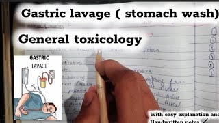 Gastric lavage stomach wash general toxicology fmt [upl. by Cirad]