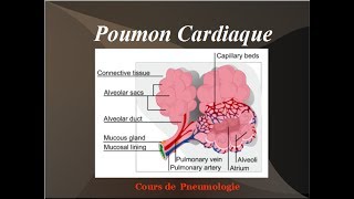 Poumon Cardiaque Oedeme aigu du poumon OAP Physiopathologie de linsuffisance cardiaque gauche [upl. by Adeuga]