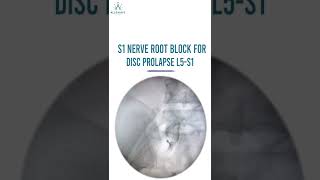 S1 Nerve Root Injection For Disc Prolapse  L5 S1 Under Fluoroscopy Guidance [upl. by Grefe174]