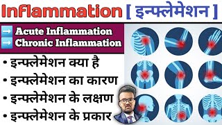 Inflammation  Inflammation and Infection  Inflammation Pathology  Inflammation in Hindi [upl. by Fabrice]