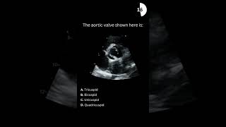 Echocardiography board practice question 01 [upl. by Curt33]