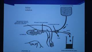 Bovine Embryo Transfer Facts2 Conventional Flush Method [upl. by Rebna]