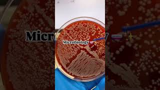 Microbiologie hospital تعلم pharmacist اكسبلور medicalstudent doctor algerie [upl. by Jerrol278]