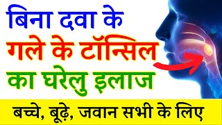 बिना दवा के गले के टॉन्सिल का घरेलू इलाज  Tonsil Treatment Cure 👉 Tonsillitis Treatment In Hindi [upl. by Trisha]